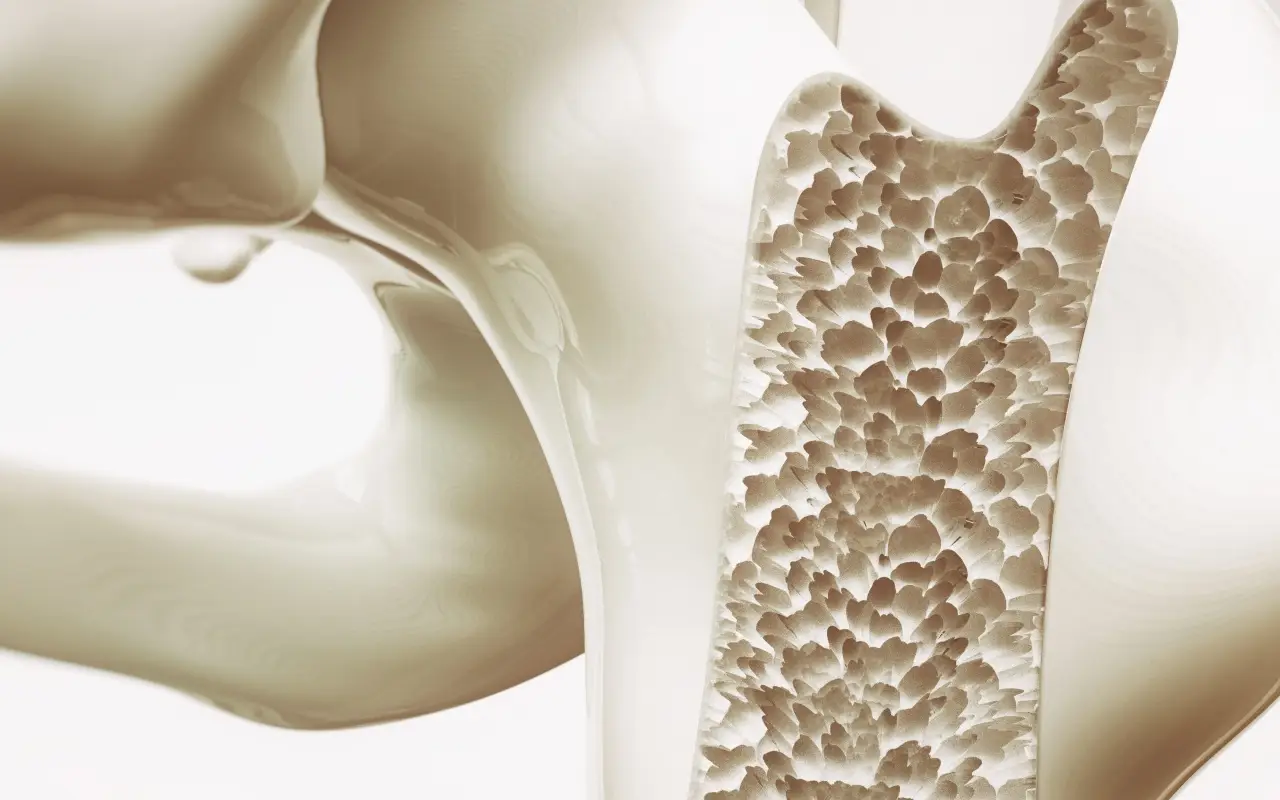 Se hai l’osteoporosi devi assolutamente mangiare questi alimenti ogni giorno